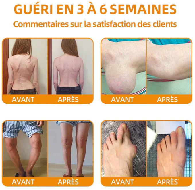 Crème Energique Bee Venom