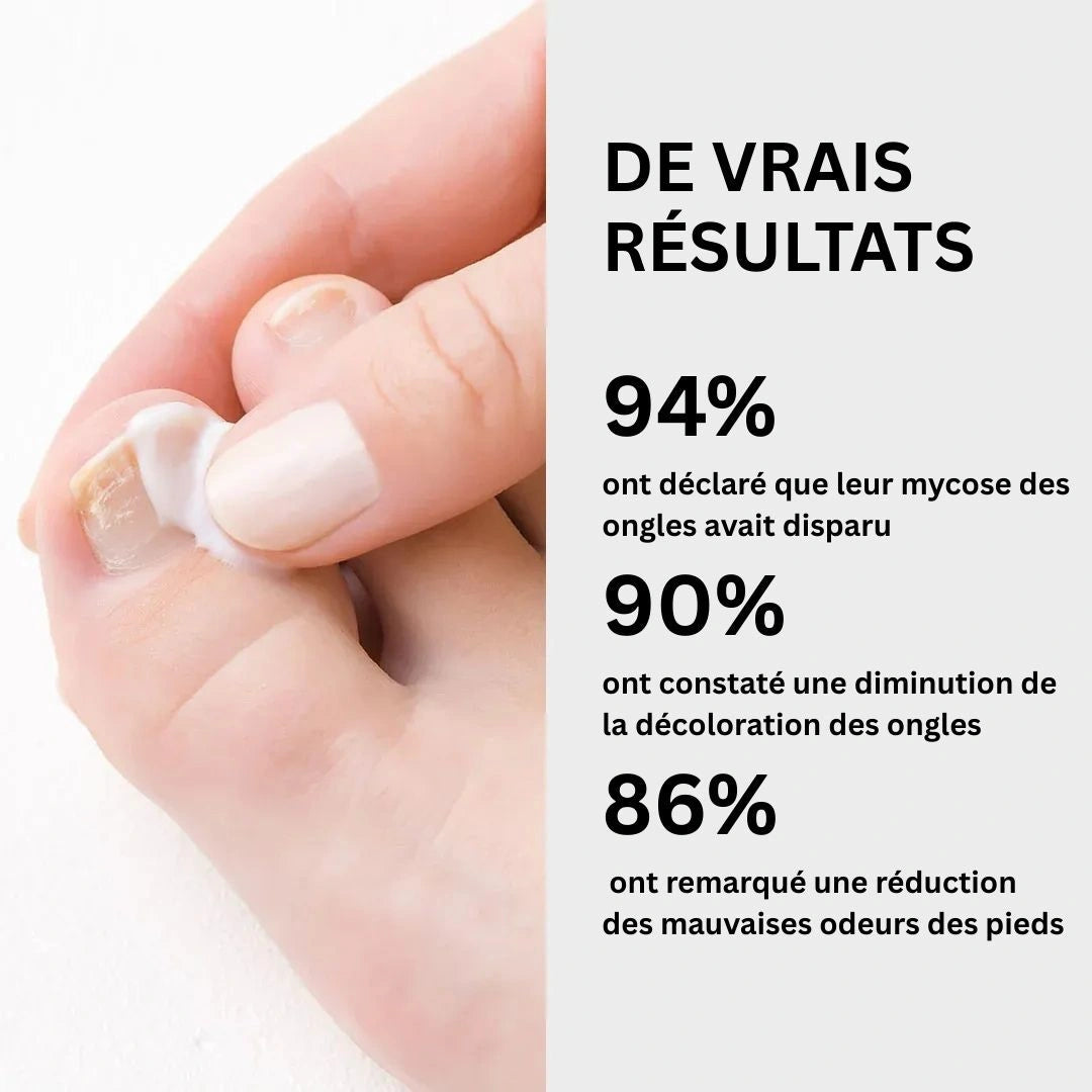 Gel contre les mycoses des ongles