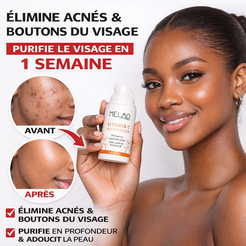 CREME BIANCA ANTITACHES NOIRES