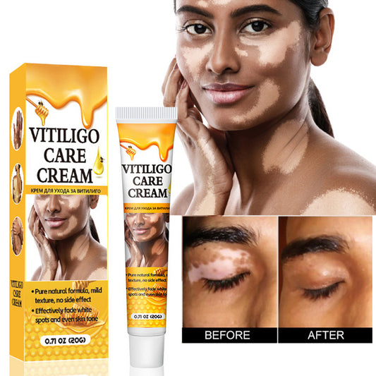 Creme anti vitiligo