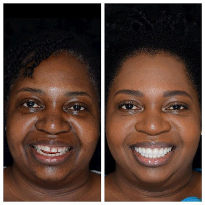 Bandes blanchissantes violettes: Dr DENT™