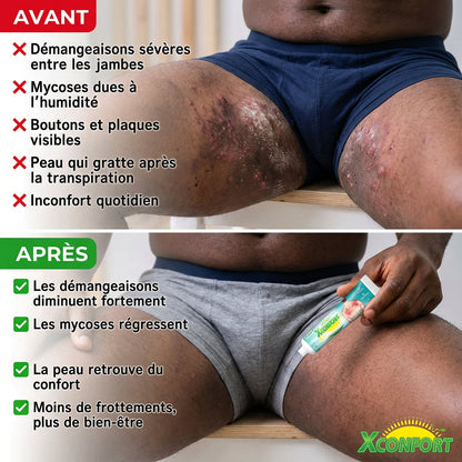 Crème de confort pour zones sensibles – Bien-être quotidien pour hommes et femmes