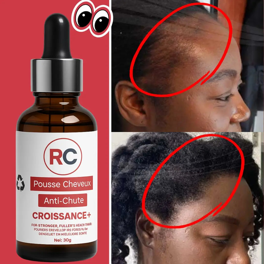 RC CROISSANCE CHEVEUX
