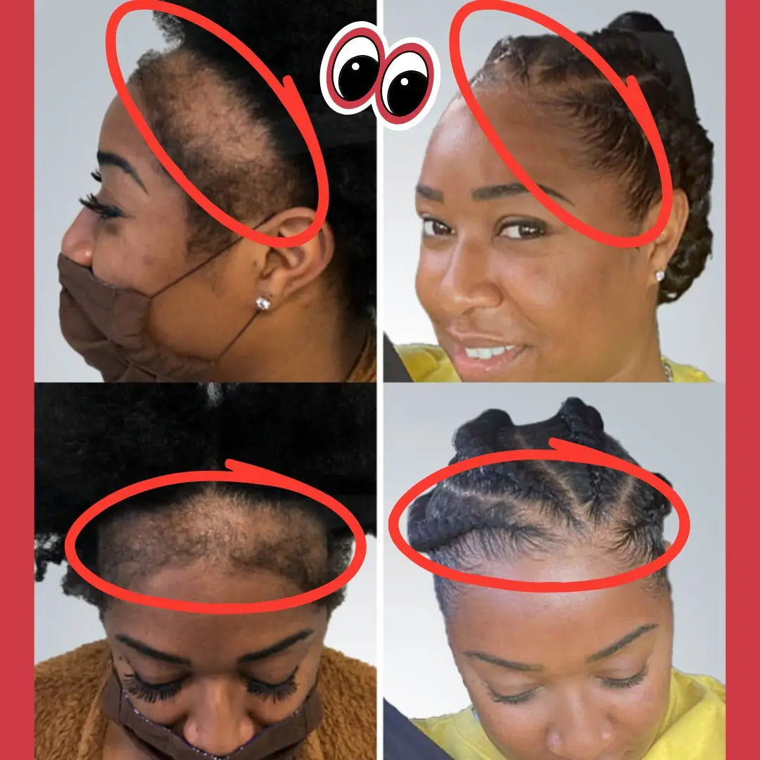 RC CROISSANCE CHEVEUX