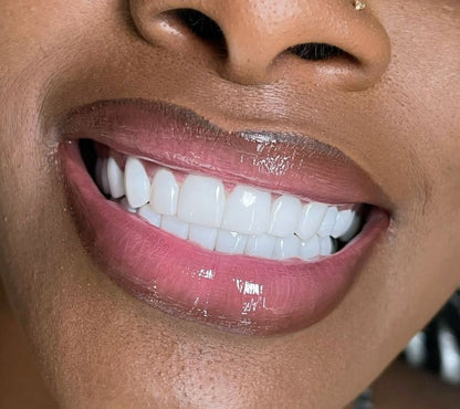 Bandes blanchissantes violettes: Dr DENT™